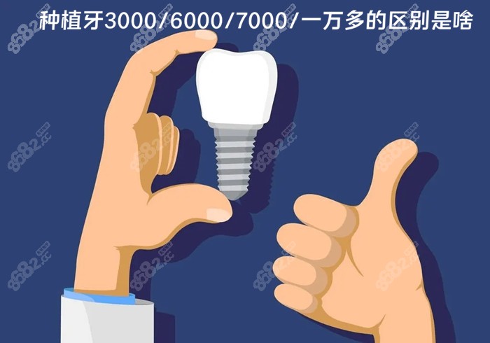 种植牙七千多和一万多的区别