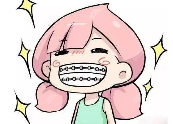 陕西宝鸡儿童牙齿矫正费用