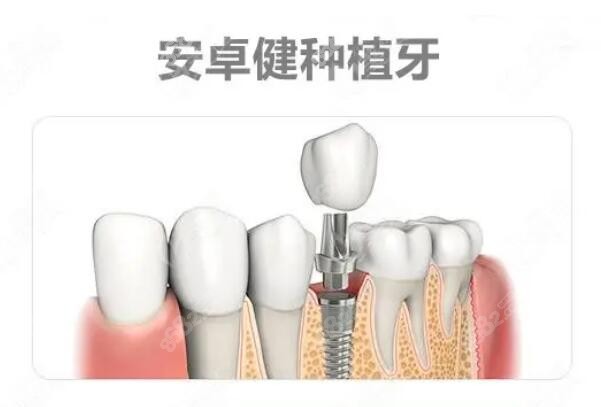 QQ截图20221102115648.jpg