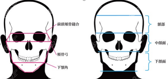 拉皮手术可提升位置