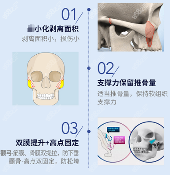 技术上看刘正茂磨骨怎么样