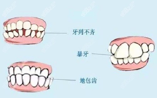 福建三明泰康医院口腔科牙齿矫正