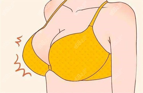 杭州美萊栗勇縮胸手術(shù)口碑評價怎么樣？