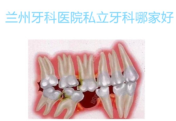 兰州牙科医院私立牙科哪家好