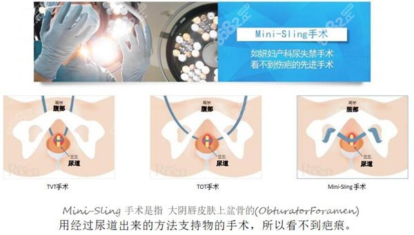 韩国私密整形医院哪家好-如研妇科医院