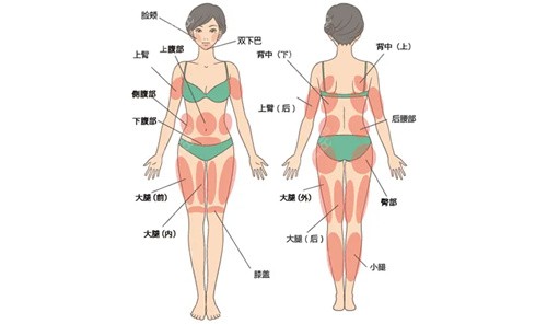 张怀军医生吸脂的技术好不好