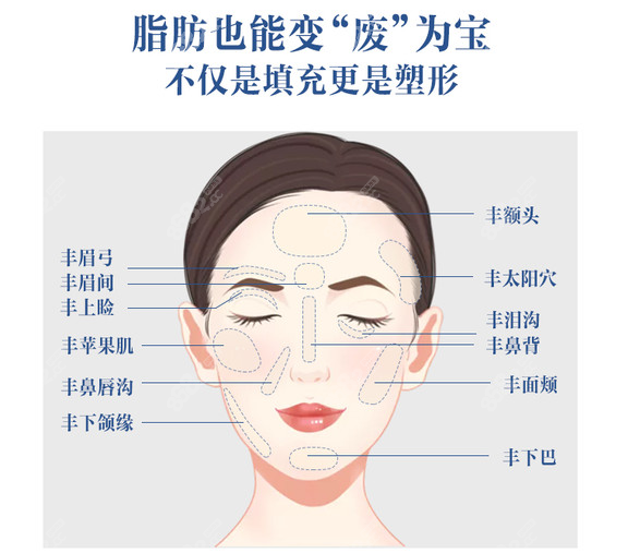 柳州做面部脂肪填充价格表m.8682.cc