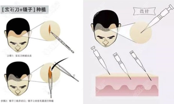 碧莲盛科发源技术对比