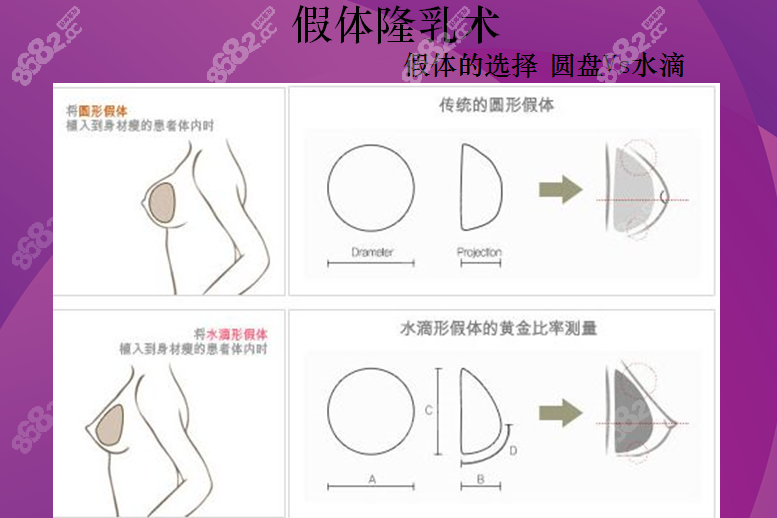 做假体隆胸适合的人群数据