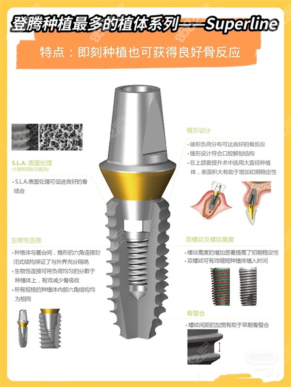 韩国纽百特和登腾哪个好