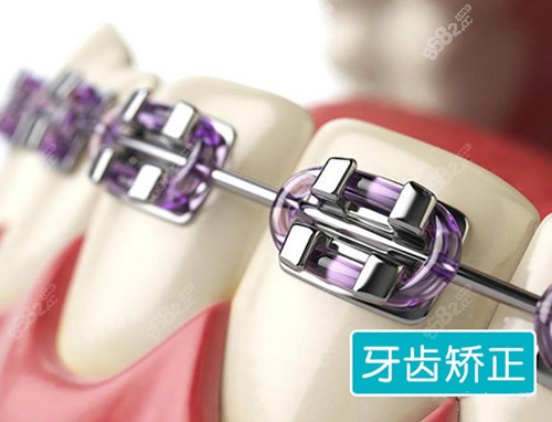 m.66ub.cn提供武漢新洲區(qū)牙齒矯正醫(yī)院排名