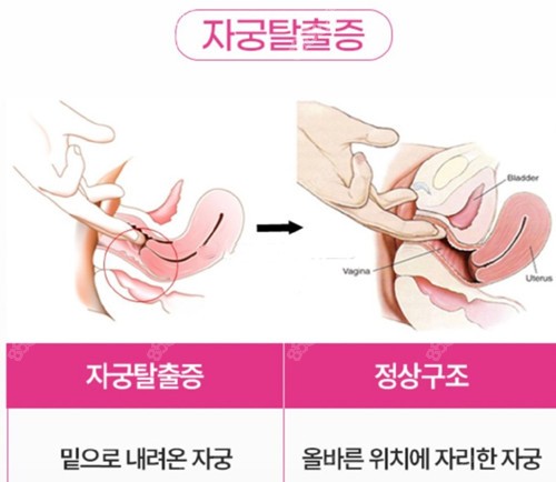 韩国好手艺妇科医院