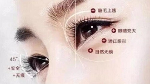 厦门欧菲医疗美容双眼皮手术