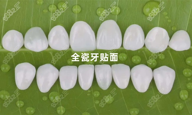 晋中做全瓷牙贴面的类型