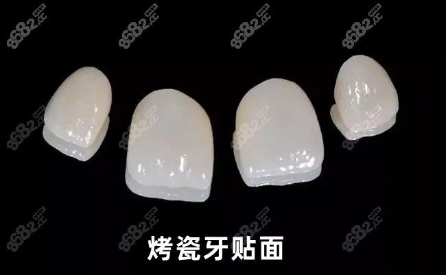 晋中牙科会选择的www.8682.cc烤瓷牙贴面