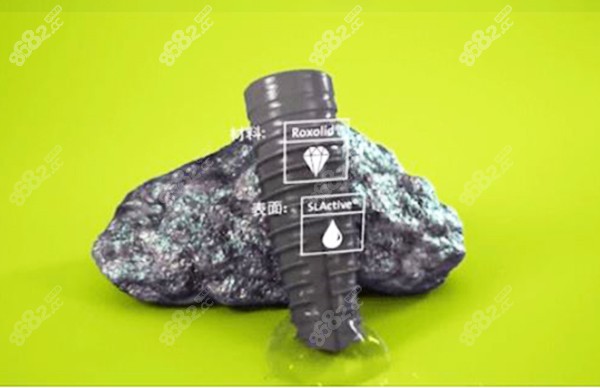圣贝口腔C-BEN数字化种植中心的植体