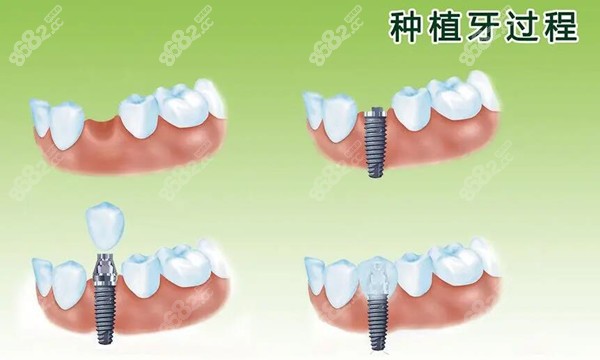 凯里牙科去哪里比较好呢