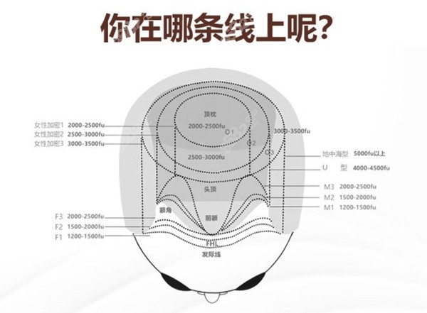 <!--<i data=20240705-sp></i>-->植发价目表www.8682.cc