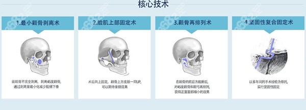 韩国菲斯莱茵faceline整形医院强项