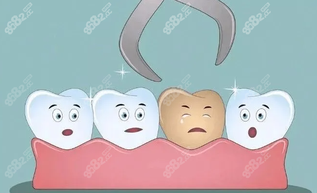 拔牙后的注意事项