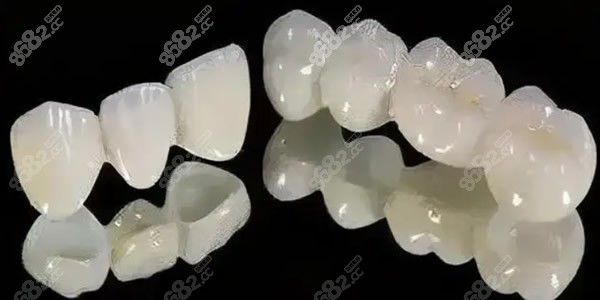 阜新王玮口腔全瓷牙多少钱