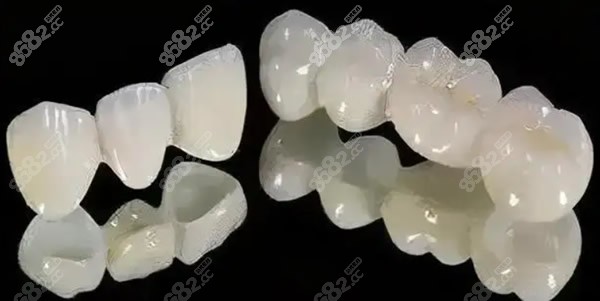 辽阳映雪口腔全瓷牙费用