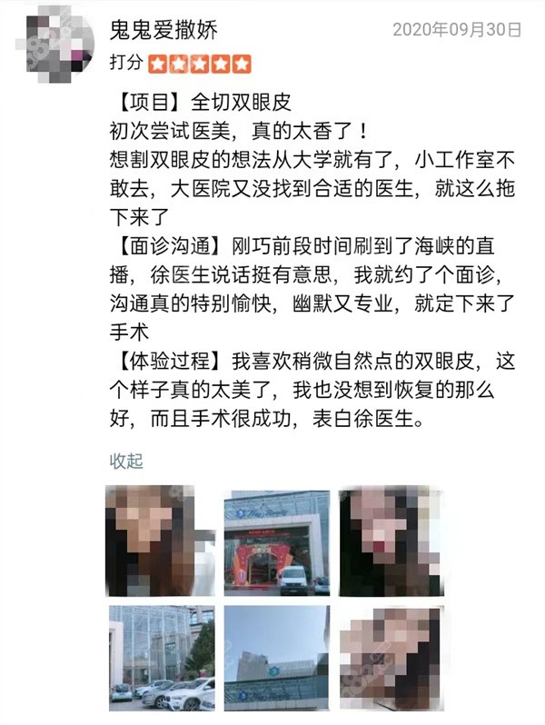 济南海峡徐永做双眼皮顾客评价图