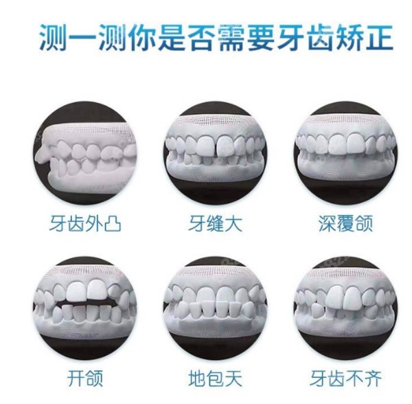 辽宁映雪口腔图片科普牙齿矫正适合哪些人