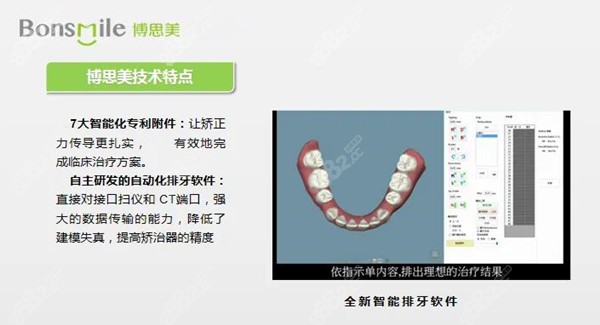 博思美bonsmile隐形矫正技术特点