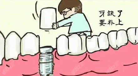 年轻人拔牙后镶牙好还是种牙