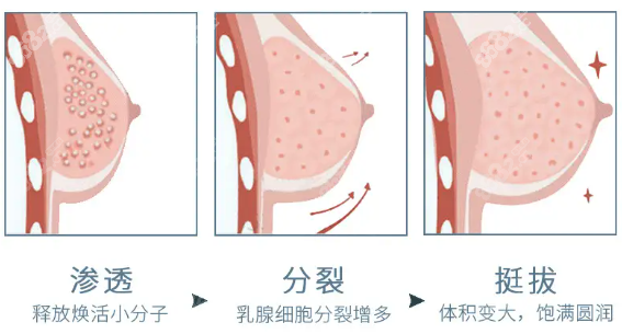 西安玻尿酸丰胸哪个医院好