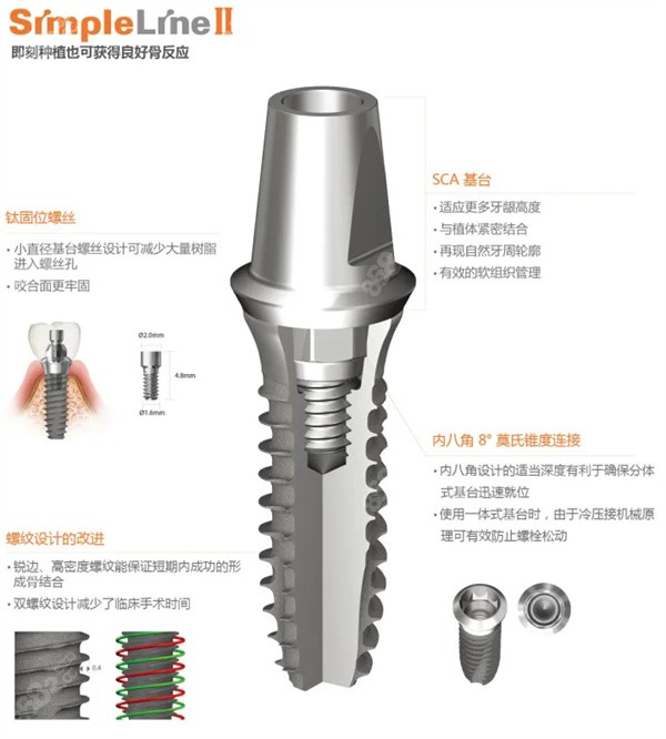 登腾种植牙4000和8000的有区别吗