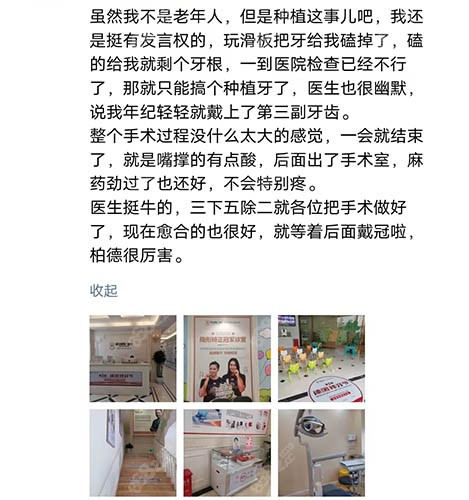 昆明柏德口腔熊俊院长种植牙评价