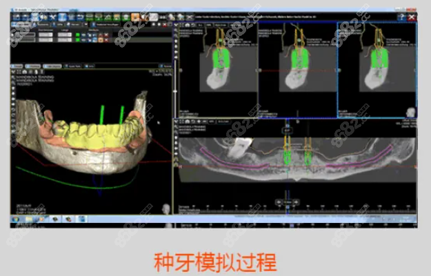 WWW.8682.CC株洲贝壳口腔做种植牙怎么样