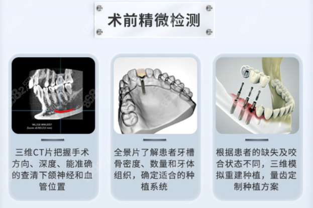 乐山英美牙科种植牙怎么样www.8682.cc