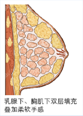 刘正茂是重庆假体隆胸出血少的医生8682.cc