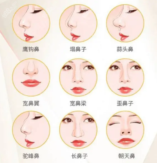 李源海做鼻子怎么樣www.sorencai.cn