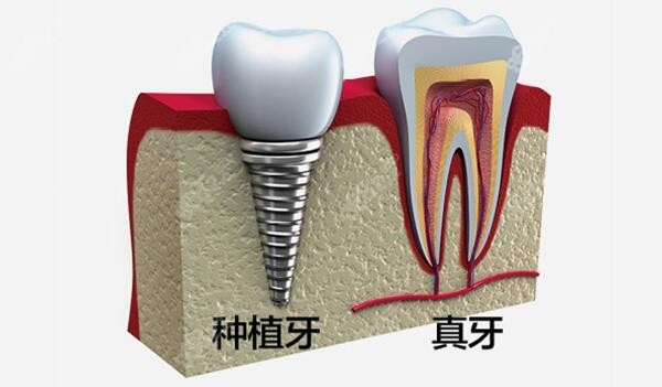 韩国奥齿泰和美国皓圣是一个公司的吗