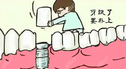 镶牙和种牙的区别