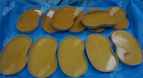 面部异物取出挂什么科？