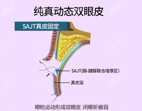 刘中策眼修复技术好吗