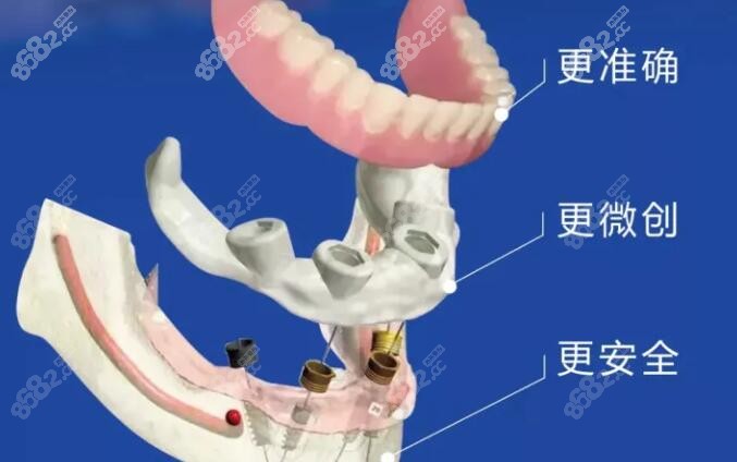 株洲贝壳口腔单颗种植牙价格在2980-15000元起