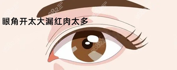 眼角开太大漏红肉明显www.8682.cc要修复