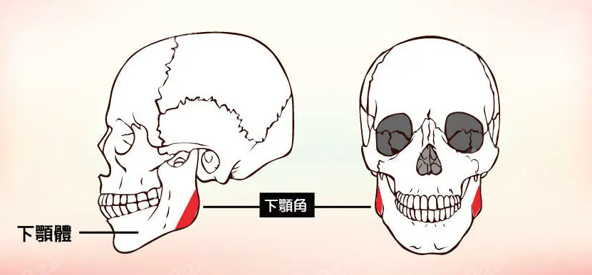 下颌角手术值得做吗