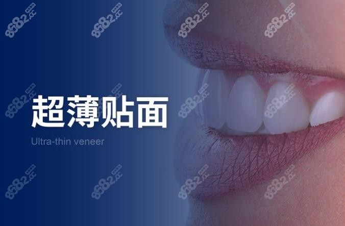 福清维乐口腔医院超薄贴面