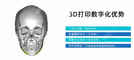 peek3d打印在临床上应用m.8682.cc