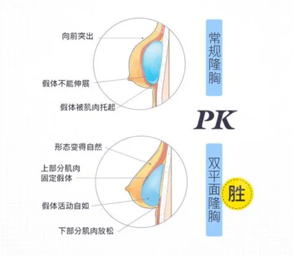 曼托假体隆胸价格是根据大小算的吗www.8682.cc