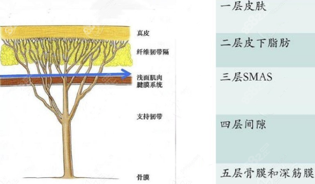 风筝小拉皮手术提拉皮肤层次示意图