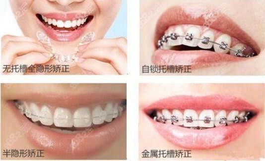 泉州盛安口腔牙齿矫正费用8682.cc