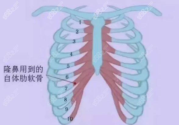 肋骨鼻一般取第几根肋软骨www.8682.cc